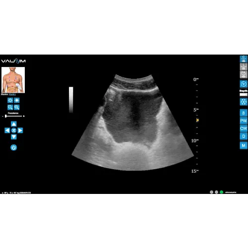 vaussim-versatile-advanced-ultrasound-simulator-1955-p.webp