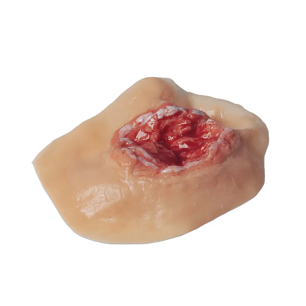 [800-008] Simulated Electrical Palm Burn