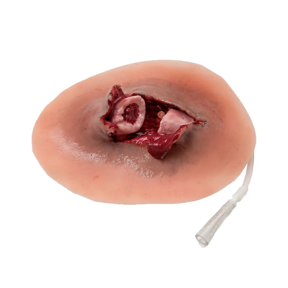Simulated Bleeding Open Fracture Clavicle 