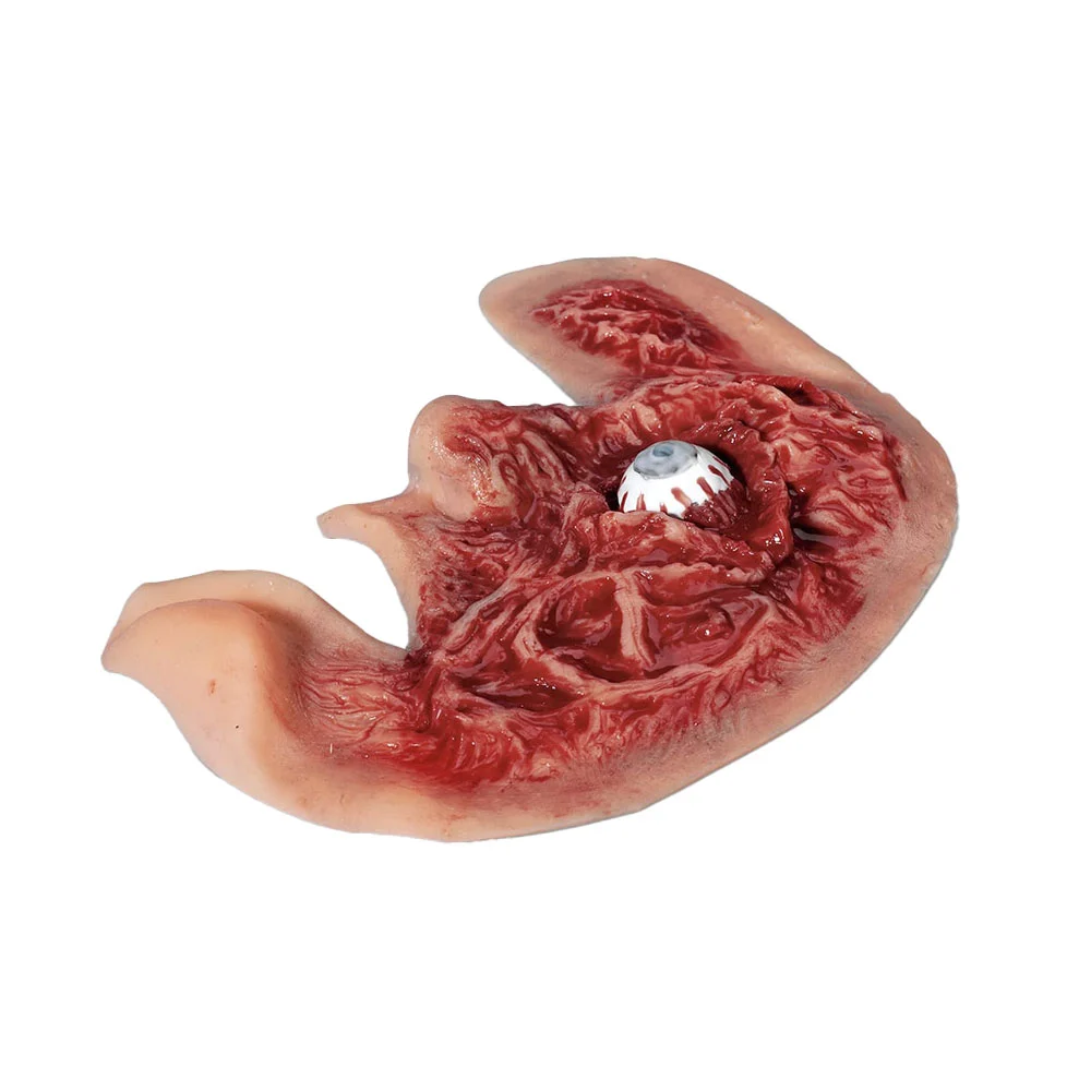 Half Face Chemical Burn