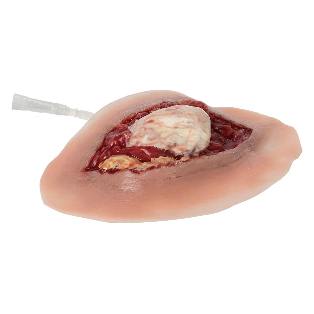 [800-618] Open Ankle Dislocation