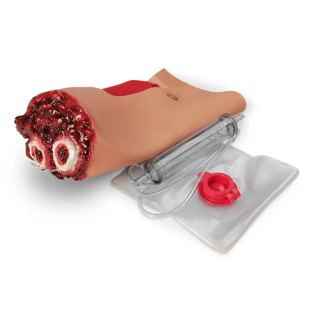 Lower Arm Amputation