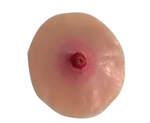 [800-651] Child Colostomy