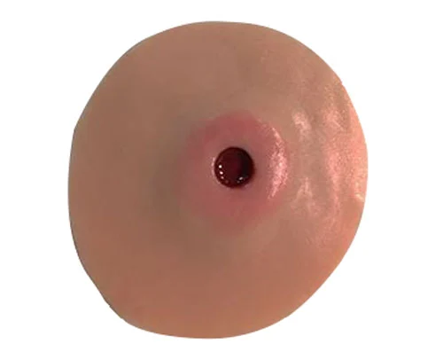 [800-652] Adult Stoma