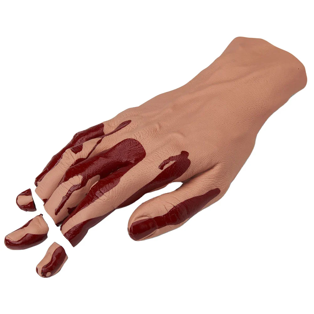 Hand with Severed Fingers