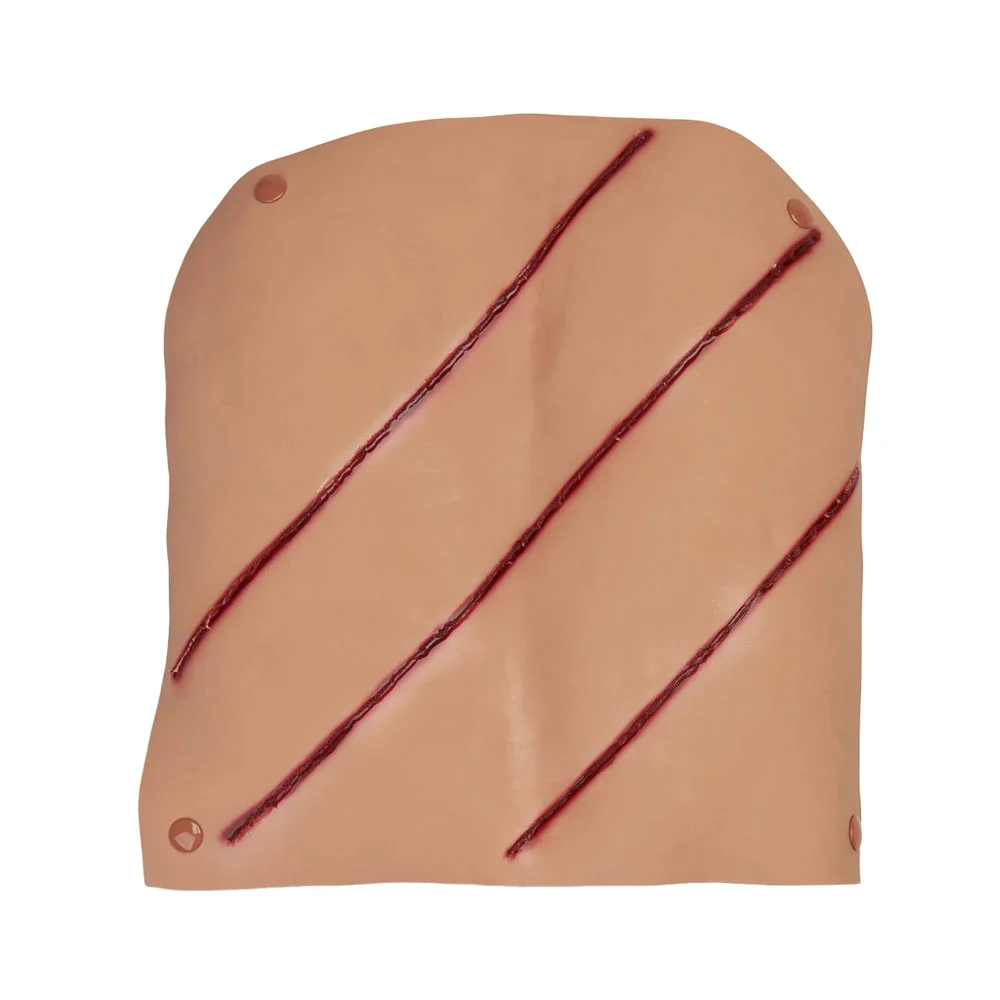 Blade/Propellor Wound