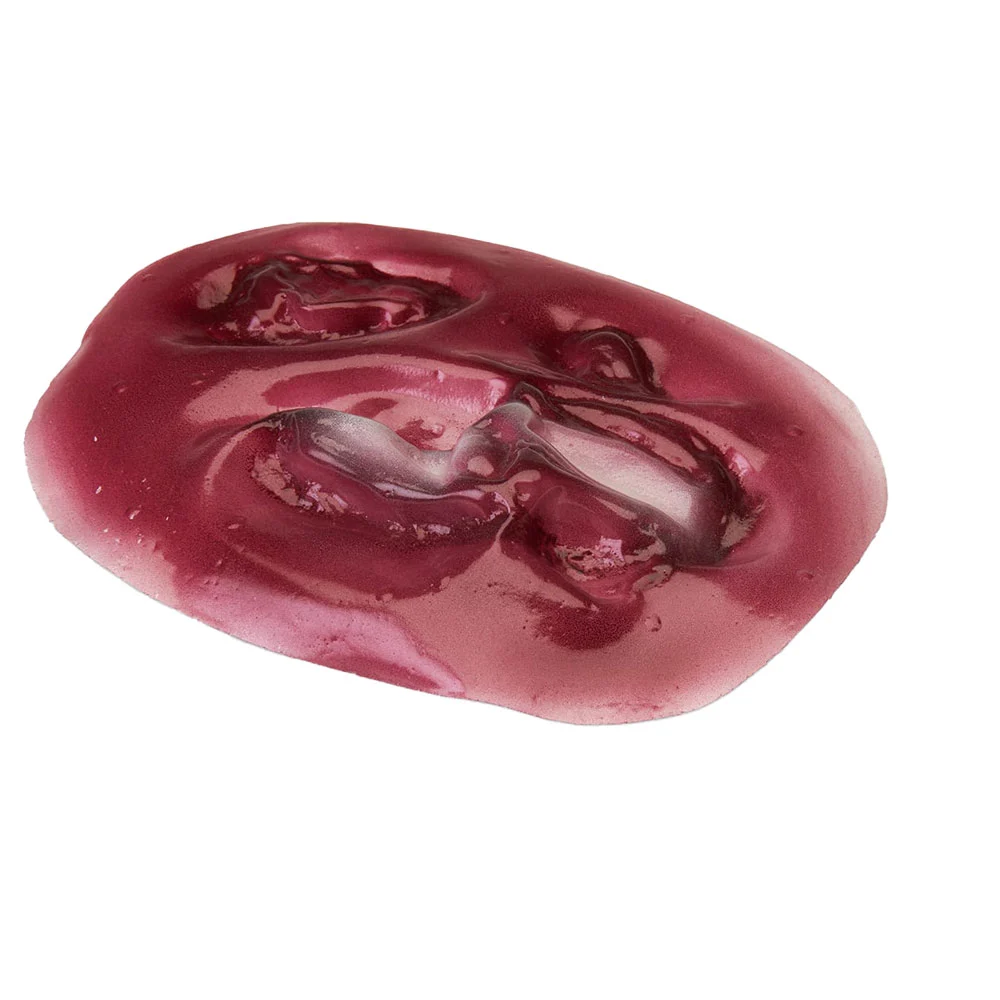 Compound Fracture Tibia (Stick-on)