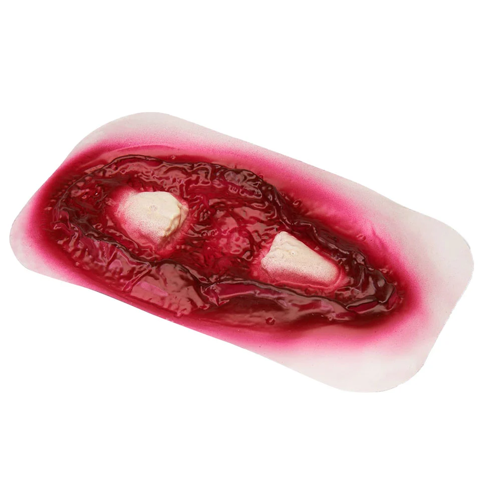 Compound Fracture Femur (Stick-on)