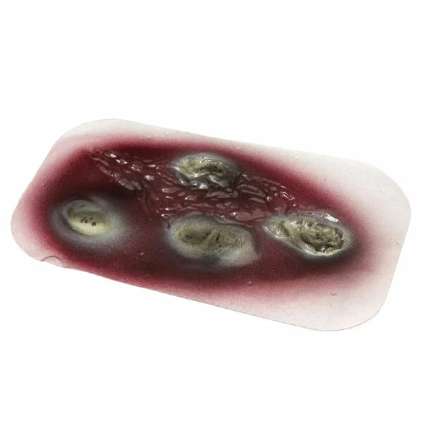 [800-914] 2nd Degree Burn (Stick-on)