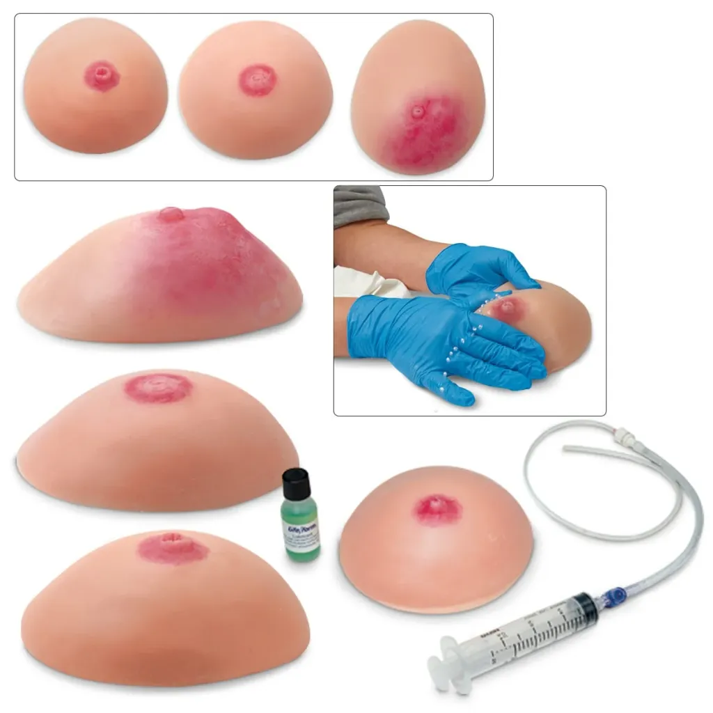 Common Breast Conditions Replica (4 Pack)