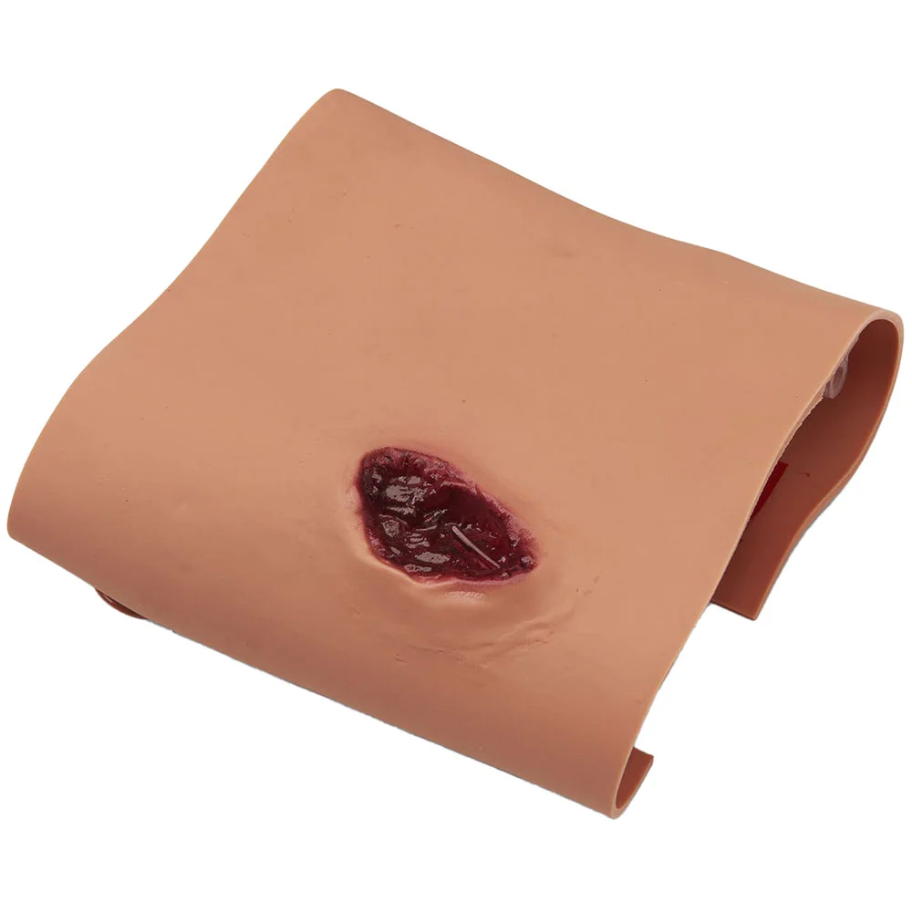 Projectile Entry/Exit Wound