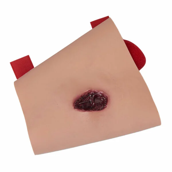 Impalement of The Lower Leg