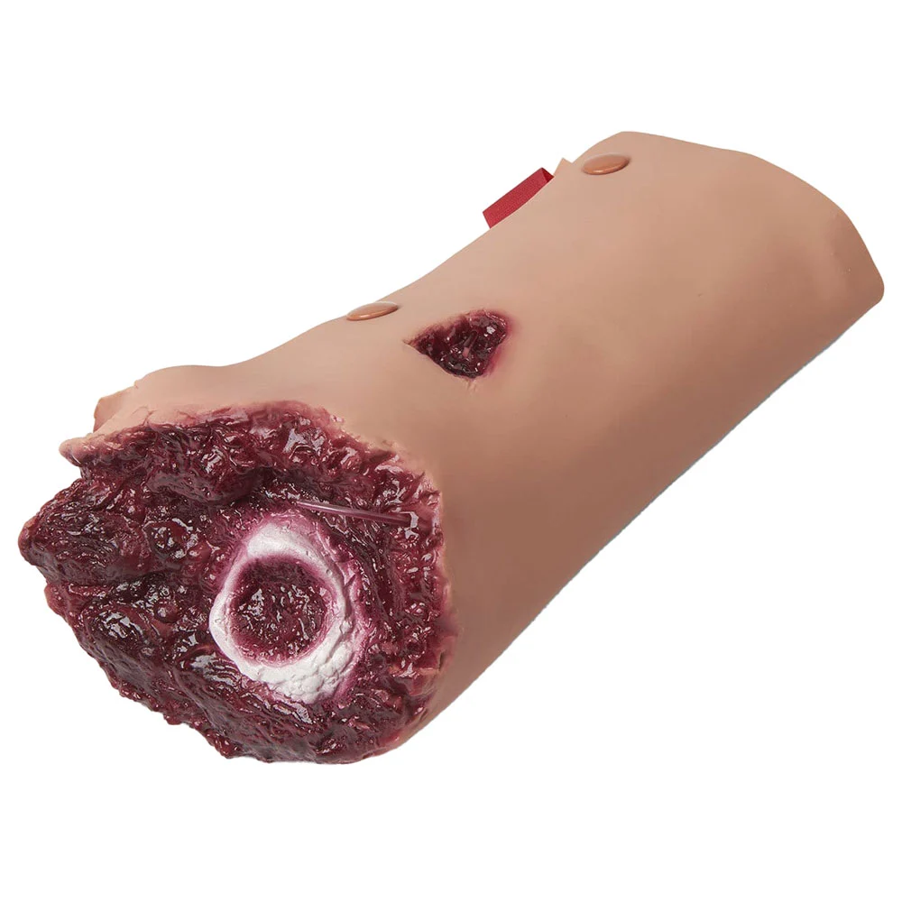 [800-6760] Leg Amputation (Light)