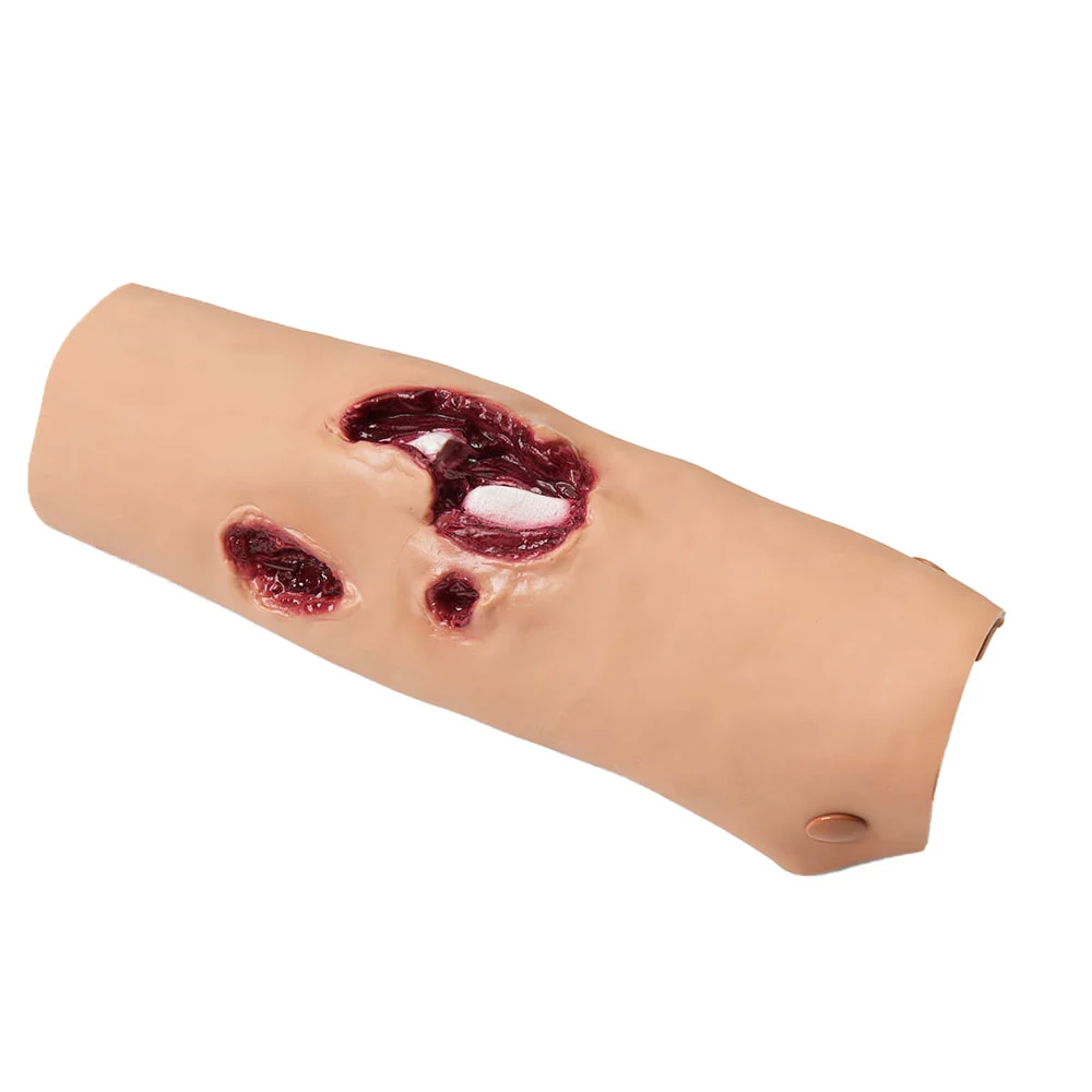 [800-6761] Tibia/Compound Fracture (Light)